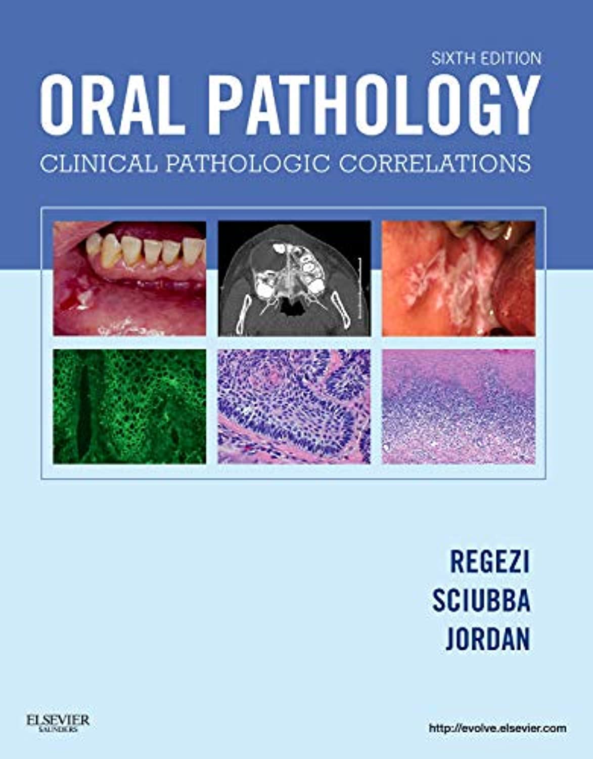 Oral Pathology: Clinical Pathologic Correlations - Sixth Edition By Regezi, Sciubba, Jordan