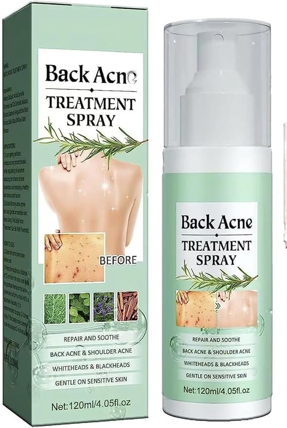 Back acne spray, Back acne salicylic acid spray, body acne spray