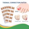 Toenail Corrector Strips