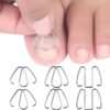6pcs /Box Ortho Wire Nail Insertion Orthotic Toe Nail Ortho Hooks