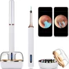 BEBIRD® Note3 Pro Max, Ultimate Version,10 Megapixel HD, All-in-1 Ear Wax Removal with Camera, Ear Wax Removal Tool with 25 Pieces, Tweezer and Rod, Bebird Ear Cleaner, for iPhone, Android (White)